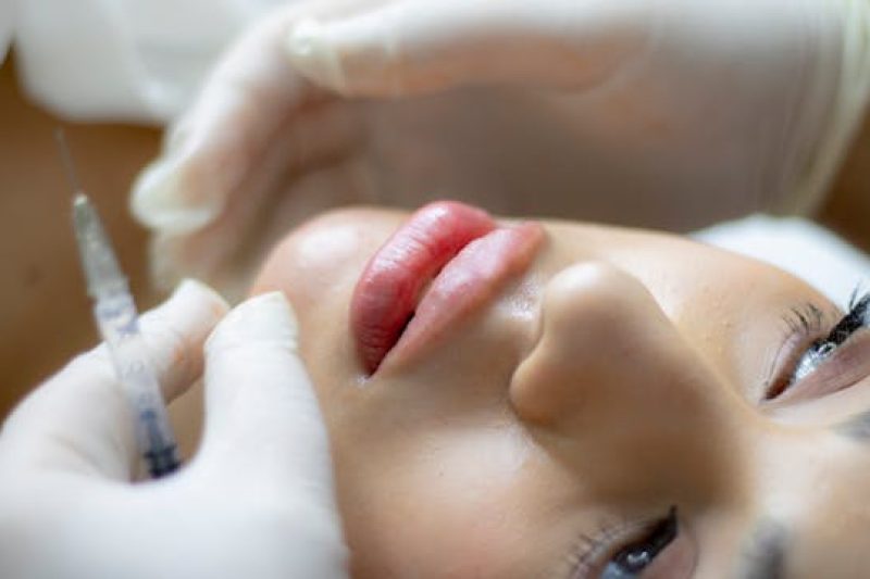 How Much Does Lip Filler Cost in San Antonio?